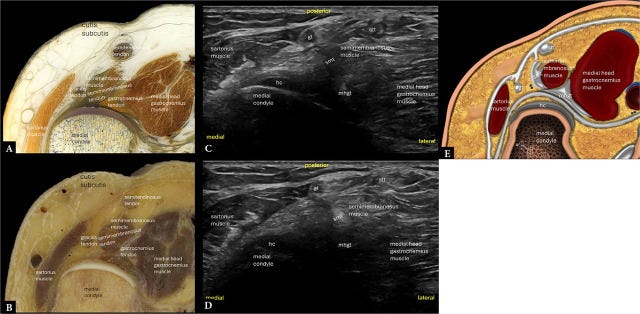 Rodilla posterior 3.jpg